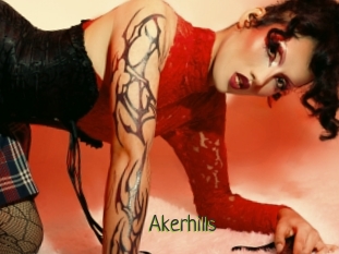 Akerhills