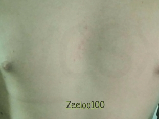 Zeeloo100